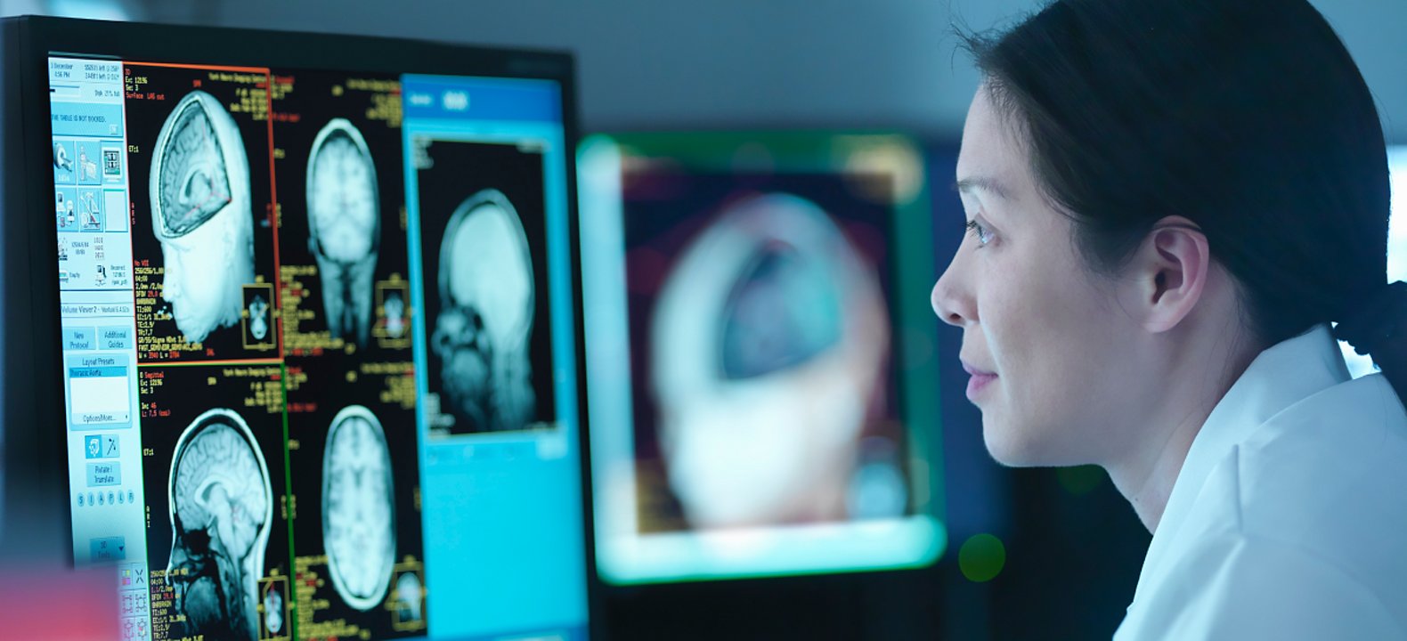 A medical professional views a patient’s brain scans on a large monitor.