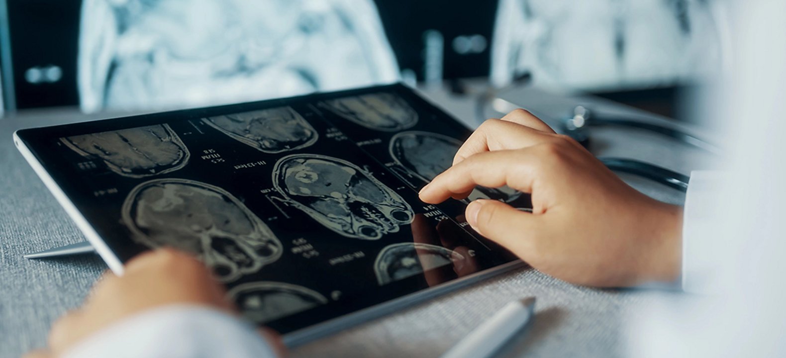 Hand looking at tablet with scans of brain.